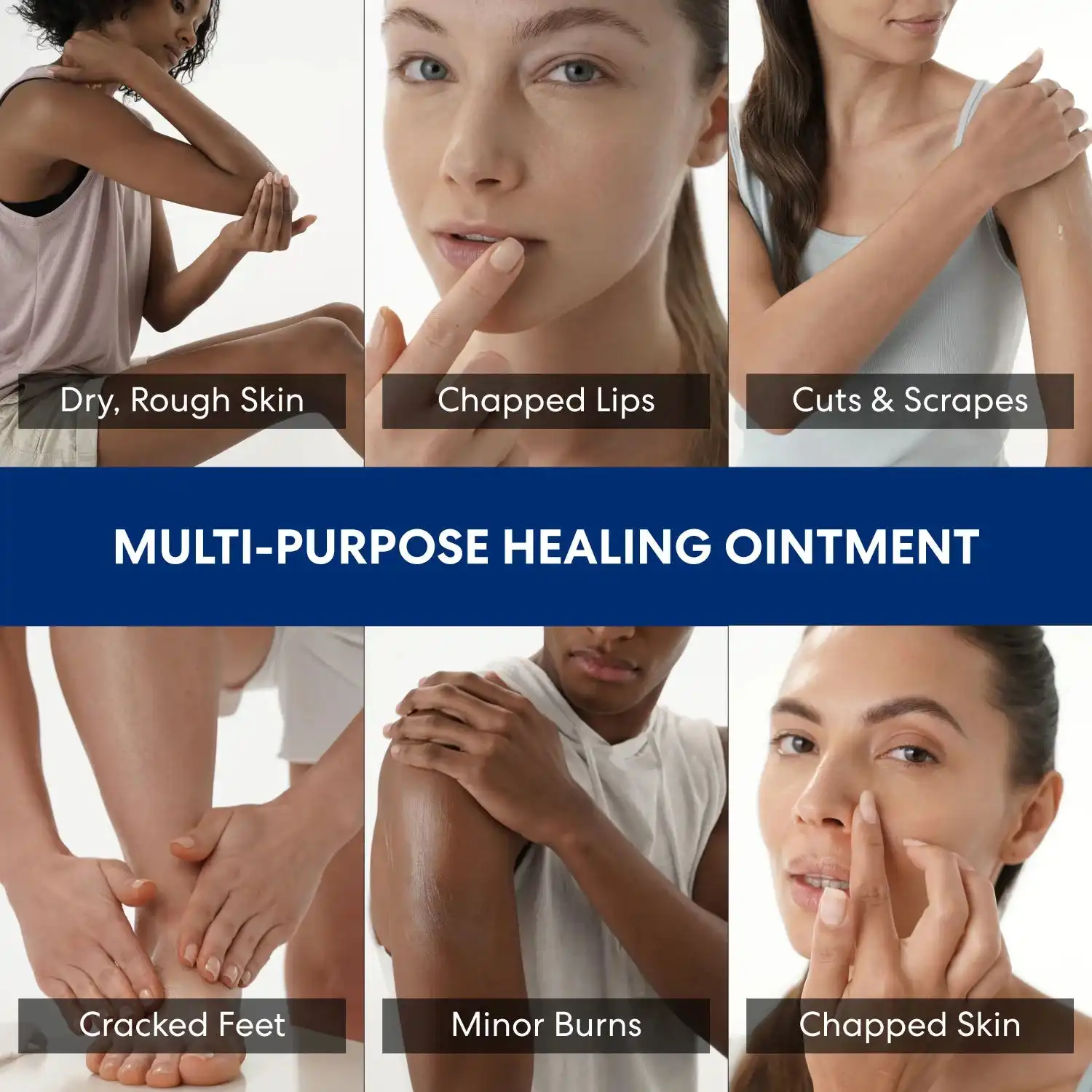Alternative view of Intensive Therapy Healing Ointment